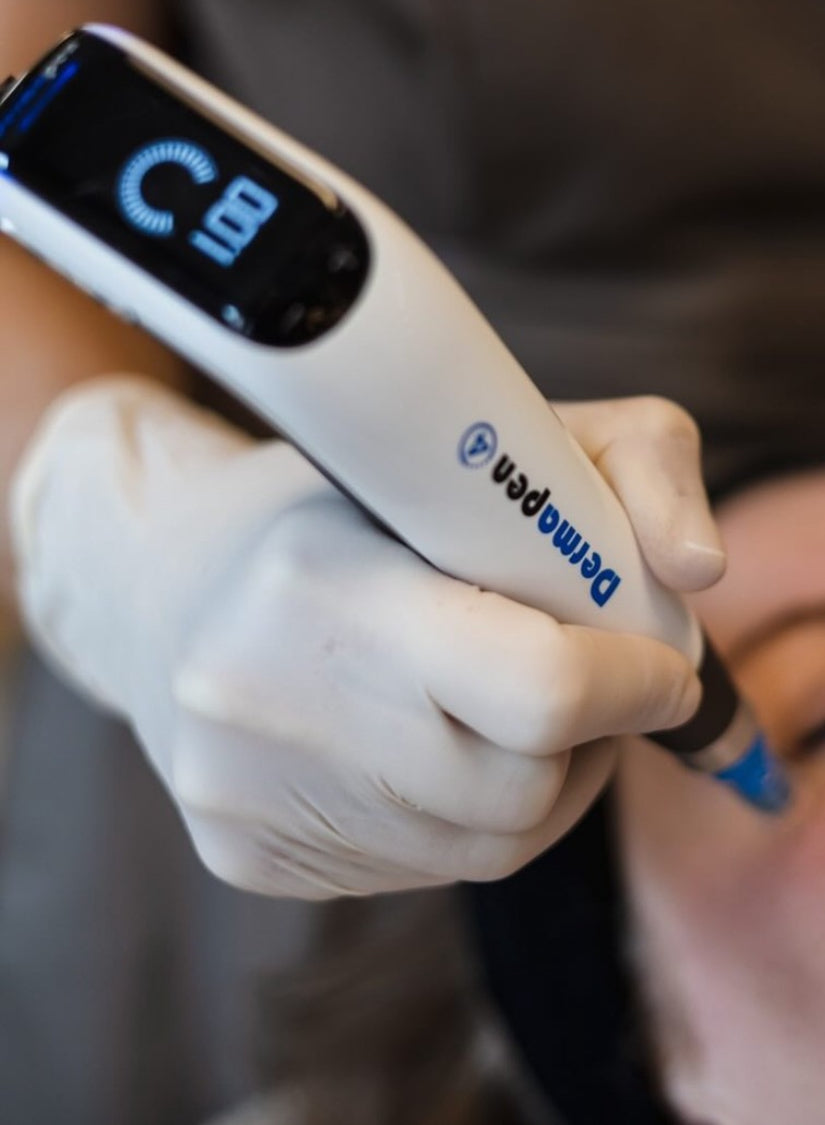 Personalized Microneedling – Actie van 01-01-2026 t/m 31-03-2026