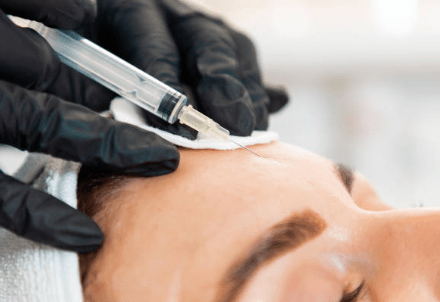 Jouw Gids voor een Natuurlijk Mooie Uitstraling in Gelderland - Beauty Kliniek Hattem 