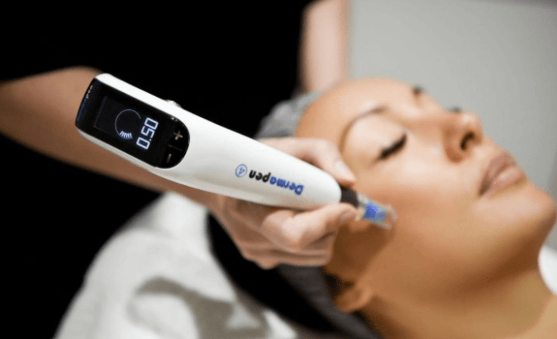 Ontdek de Kracht van Microneedling - Beauty Kliniek Hattem 