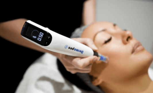 Ontdek de Kracht van Microneedling - Beauty Kliniek Hattem 